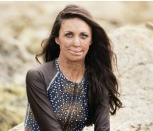 After a fire damaged his wife’s beauty, the husband refuses to leave ...
